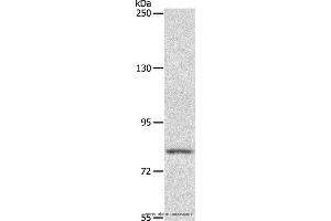 Western blot analysis of Mouse liver tissue, using ABCB6 Polyclonal Antibody at dilution of 1:250