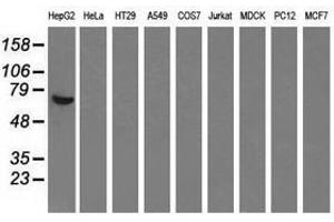 Image no. 4 for anti-alpha-Fetoprotein (AFP) antibody (ABIN1496486) (alpha Fetoprotein 抗体)