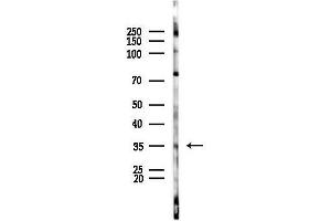 anti-Duffy Blood Group, Chemokine Receptor (DARC) (N-Term) antibody