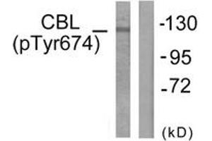 Western blot analysis of extracts from HepG2 cells treated with Na2VO3 0. (CBL 抗体  (pTyr674))