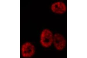 Immunofluorescence (fixed cells) (IF/ICC) image for anti-Paired Box 3 (PAX3) (Internal Region) antibody (ABIN6264052)