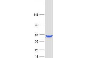 Western Blotting (WB) image for Glyoxylate Reductase/hydroxypyruvate Reductase (GRHPR) protein (Myc-DYKDDDDK Tag) (ABIN2722245)