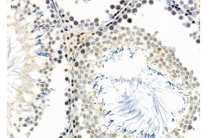 ABIN6261240 and ABIN6266855 at 1/100 staining Rat testis tissue by IHC-P. (DCP1A 抗体  (Internal Region))