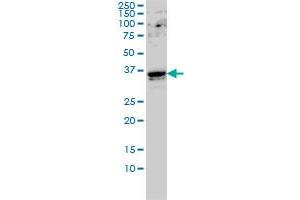 GTF2E2 monoclonal antibody (M01A), clone 2C3 Western Blot analysis of GTF2E2 expression in Hela S3 NE . (GTF2E2 抗体  (AA 1-291))