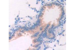 IHC-P analysis of Rat Tissue, with DAB staining. (TPSAB1 抗体  (AA 29-148))