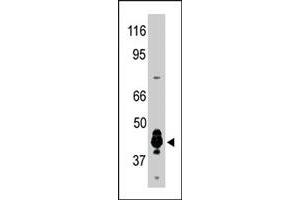 The PRMT6 polyclonal antibody  was used to detect human PRMT6 protein in human brain extract in a Western blot analysis. (PRMT6 抗体  (N-Term))