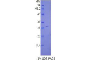 SDS-PAGE analysis of Mouse Cathepsin C Protein. (CTSC 蛋白)