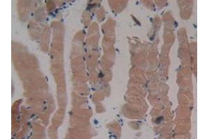 IHC-P analysis of Mouse Skeletal Muscle Tissue, with DAB staining. (MYH2 抗体  (AA 1238-1472))