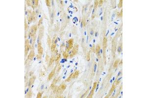 Immunohistochemistry of paraffin-embedded mouse heart using PHPT1 antibody (ABIN3021488, ABIN3021489, ABIN3021490 and ABIN6215139) at dilution of 1:100 (40x lens). (PHPT1 抗体  (AA 1-125))