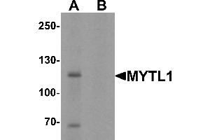 Western Blotting (WB) image for anti-Myelin Transcription Factor 1-Like (MYT1L) (C-Term) antibody (ABIN1077393) (MYT1L 抗体  (C-Term))