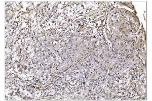 IHC analysis of NDEL1 using anti-NDEL1 antibody (ABIN7602511). (NDEL1 抗体  (AA 80-320))