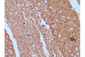 Detection of STMN1 in Human Cerebrum Tissue using Polyclonal Antibody to Stathmin 1 (STMN1) (Stathmin 1 抗体  (AA 2-149))