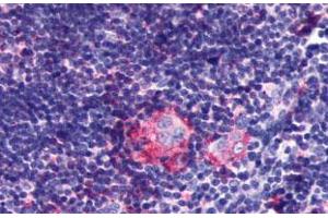 Immunohistochemical (Formalin/PFA-fixed paraffin-embedded sections) staining in human thymus with P2RY5 polyclonal antibody . (LPAR6 抗体  (2nd Extracellular Domain))