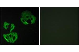 Immunofluorescence analysis of A549 cells, using MADD Antibody. (MADD 抗体  (AA 751-800))