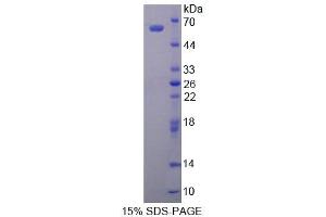 SDS-PAGE analysis of Human ALDH1A1 Protein. (ALDH1A1 蛋白)