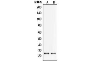 Western blot analysis of PGRMC2 expression in HL60 (A), HeLa (B) whole cell lysates. (PGRMC2 抗体  (C-Term))