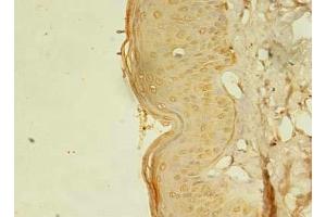Immunohistochemistry of paraffin-embedded human skin tissue using ABIN7168075 at dilution of 1:100 (RTKN2 抗体  (AA 1-163))