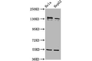 Western Blot Positive WB detected in: Hela whole cell lysate, HepG2 whole cell lysate All lanes: RECQL4 antibody at 4.
