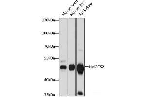 Western blot analysis of extracts of various cell lines using HMGCS2 Polyclonal Antibody at dilution of 1:1000. (HMGCS2 抗体)