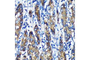 Immunohistochemistry (IHC) image for anti-Thioredoxin Domain Containing 12 (Endoplasmic Reticulum) (TXNDC12) (AA 93-172) antibody (ABIN7270800)