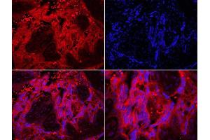 Formalin-fixed and paraffin embedded human placenta labeled with Rabbit Anti-TLR7 Polyclonal Antibody, Unconjugated  DAPI staining (TLR7 抗体  (AA 461-560))