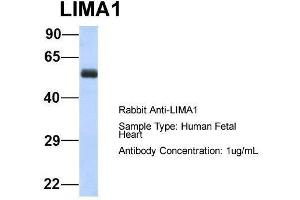 Host:  Rabbit  Target Name:  LIMA1  Sample Type:  Human Fetal Heart  Antibody Dilution:  1. (LIMA1 抗体  (N-Term))