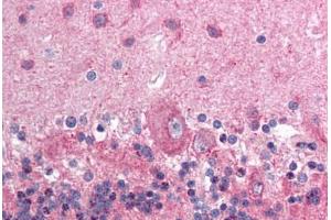 Human Brain, Cerebellum (formalin-fixed, paraffin-embedded) stained with NCOR1 antibody ABIN214125 at 5 ug/ml followed by biotinylated goat anti-rabbit IgG secondary antibody ABIN481713, alkaline phosphatase-streptavidin and chromogen. (NCOR1 抗体  (AA 484-533))