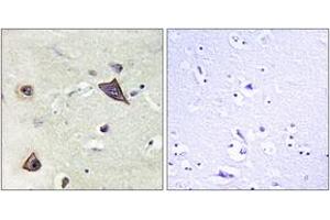Immunohistochemistry analysis of paraffin-embedded human brain tissue, using NMDAR1 (Ab-896) Antibody. (GRIN1/NMDAR1 抗体  (AA 862-911))