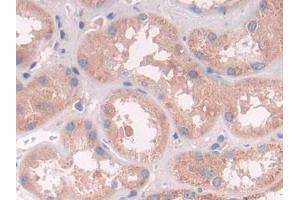 Immunohistochemistry (IHC) image for anti-ATPase, H+ Transporting, Lysosomal Accessory Protein 2 (ATP6AP2) (AA 17-302) antibody (ABIN7439744)