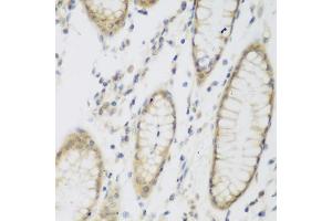 Immunohistochemistry of paraffin-embedded human stomach using NB antibody (ABIN6132989, ABIN6144383, ABIN6144385 and ABIN6223030) at dilution of 1:200 (40x lens). (NAT8B 抗体  (AA 75-165))
