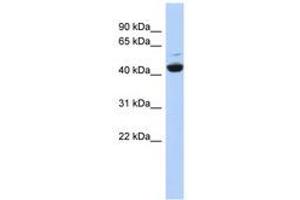 Image no. 1 for anti-ATPase, H+ Transporting, Lysosomal 42kDa, V1 Subunit C1 (ATP6V1C1) (AA 61-110) antibody (ABIN6741468)