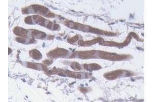 Detection of PLIN1 in Mouse Skin Tissue using Polyclonal Antibody to Perilipin 1 (PLIN1) (PLIN1 抗体  (AA 1-210))