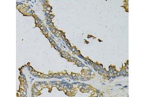 Immunohistochemistry of paraffin-embedded Human prostate using RPLP0 Polyclonal Antibody at dilution of 1:100 (40x lens). (RPLP0 抗体)