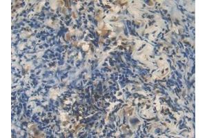 Immunohistochemistry (IHC) image for anti-Heat Shock 70kDa Protein 1A (HSPA1A) (AA 1-641) antibody (ABIN7433138)