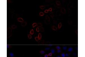 Immunofluorescence analysis of HeLa cells using FLNA Polyclonal Antibody at dilution of 1:100 (40x lens). (Filamin A 抗体)