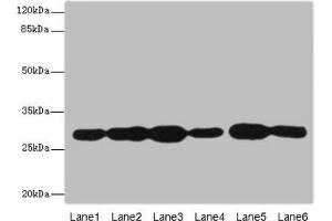 Western blot All lanes: PMM2 antibody at 3. (PMM2 抗体  (AA 1-246))