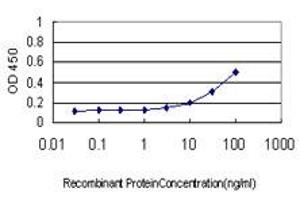 Detection limit for recombinant GST tagged AKT1 is approximately 1ng/ml as a capture antibody. (AKT1 抗体  (AA 1-480))