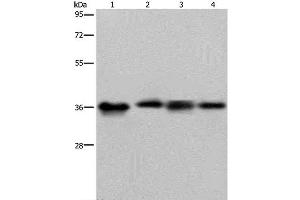 Western Blot analysis of HepG2 and 293T cell, Human kidney cancer tissue and K562 cell using JAM-A Polyclonal Antibody at dilution of 1:500 (F11R 抗体)