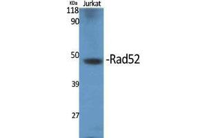 Western Blot (WB) analysis of specific cells using Rad52 Polyclonal Antibody. (RAD52 抗体  (Thr56))