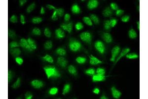 Immunofluorescence analysis of A549 cell using BIRC2 antibody. (BIRC2 抗体)