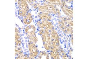 Immunohistochemistry of paraffin-embedded rat kidney using ALDH2 antibody. (ALDH2 抗体)