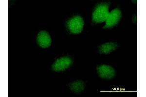 Immunofluorescence of  purified  MaxPab antibody to CBX6 on HeLa cell. (CBX6 抗体  (AA 1-412))