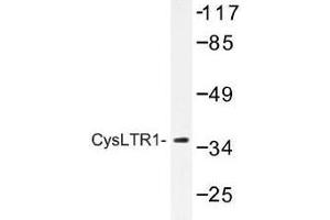 Image no. 1 for anti-Cysteinyl Leukotriene Receptor 1 (CYSLTR1) antibody (ABIN317699) (CysLTR1 抗体)