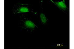 Immunofluorescence of monoclonal antibody to ZNF598 on HeLa cell. (ZNF598 抗体  (AA 28-126))
