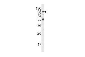 Western blot analysis of PI3KR5 Antibody Pab in K562 cell line lysates (35ug/lane). (PIK3R5 抗体  (AA 392-421))