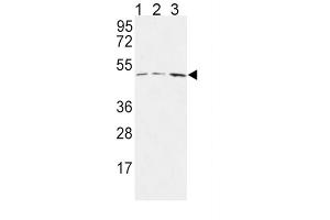 Western Blotting (WB) image for anti-Hyaluronan and Proteoglycan Link Protein 1 (HAPLN1) antibody (ABIN3004323) (HAPLN1 抗体)