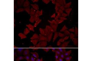 Immunofluorescence analysis of HeLa cells using CCT4 Polyclonal Antibody (CCT4 抗体)