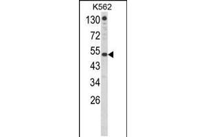 Western blot analysis of IFNAR1 Antibody in K562 cell line lysates (35ug/lane)(8ug/ml) (IFNAR1 抗体  (AA 162-188))