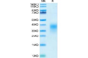 SDS-PAGE (SDS) image for Inducible T-Cell Co-Stimulator (ICOS) (AA 21-141), (C136S), (C137S) protein (His tag) (ABIN7274838)