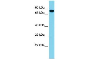 Host: Rabbit Target Name: GGA2 Sample Type: Placenta lysates Antibody Dilution: 1. (GGA2 抗体  (N-Term))